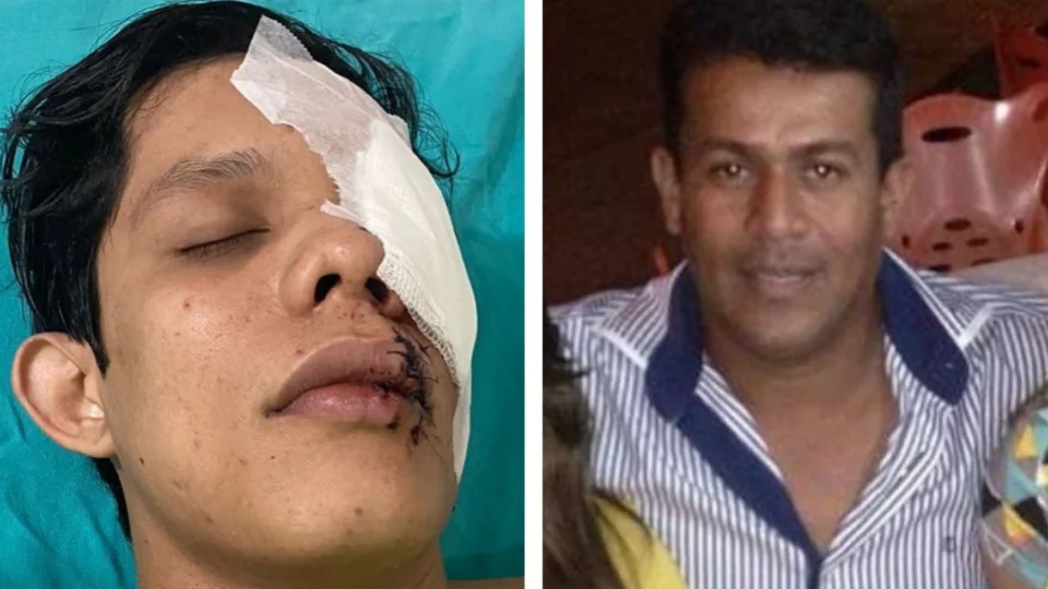 Empresário que agrediu jovem com copo de vidro tem prisão preventiva negada