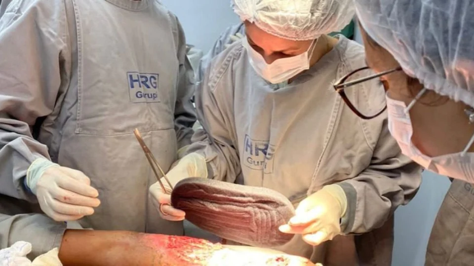 TO: HRG adere técnica inovadora para tratar feridas de difícil cicatrização