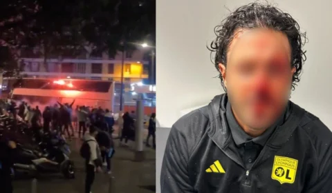 VÍDEO: ônibus do Lyon é apedrejado na França; técnico foi atingido 