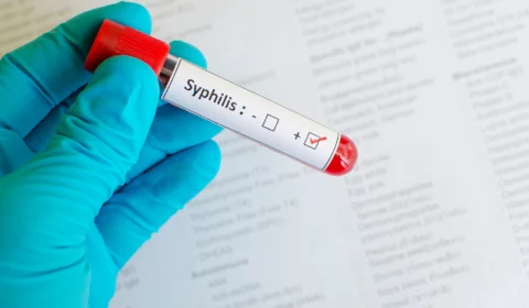 Campanha Outubro Verde alerta para prevenção e combate à Sífilis