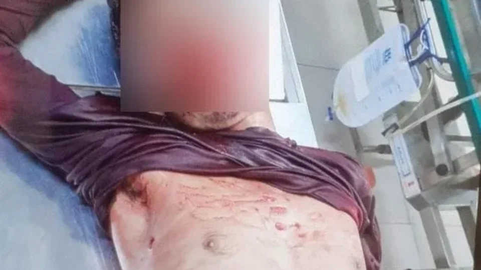 Acusado de matar motorista de aplicativo morre em tiroteio, em RR