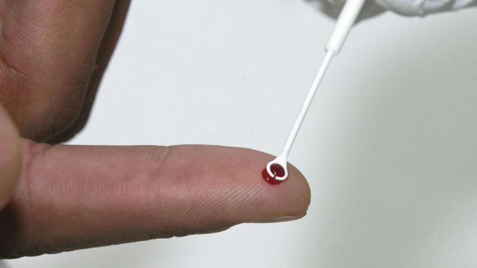 Acre registra aumento de quase 12% nos casos de HIV em adultos; Rio Branco lidera o ranking