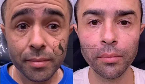 Influencer? Motorista que atropelou Kayky Brito tem contato para ‘publis’