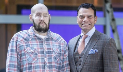 EUA realiza 1º transplante total de olho e parcial de rosto do mundo