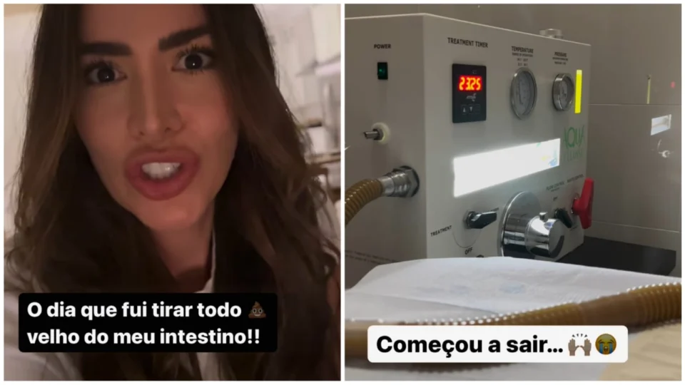 Hidrocolonterapia: ex-BBB faz procedimento para ‘tirar cocô velho’