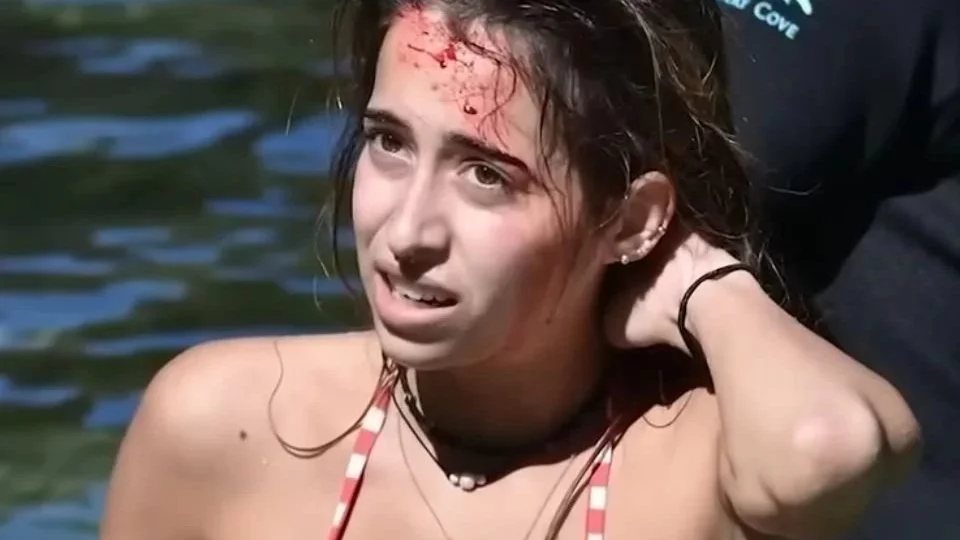 Jovem sobrevive após ser mordida na cabeça por crocodilo de 3 metros nos EUA