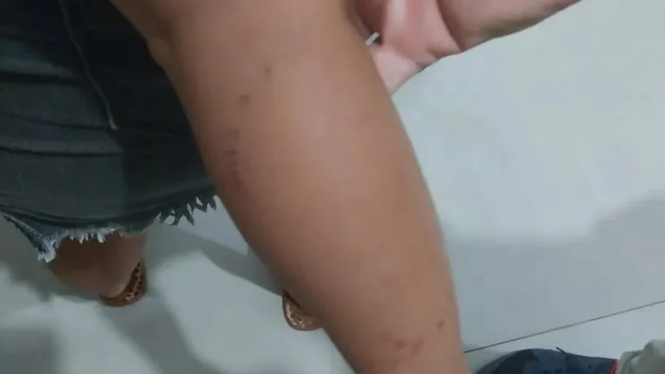 VÍDEO: sucuri de quase 6 metros é morta ao atacar criança em Goiás