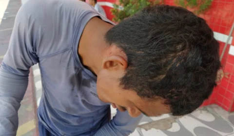 Homem é agredido na cabeça, mas se nega a prestar queixa em Boa Vista-RR