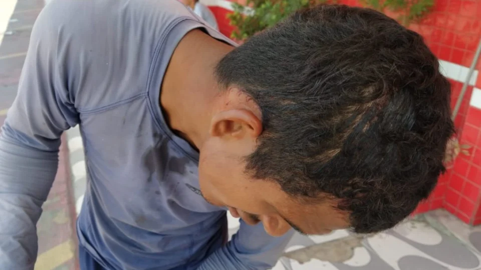 Homem é agredido na cabeça, mas se nega a prestar queixa em Boa Vista-RR