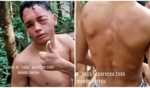 VÍDEO: jovem é atacado por cabas em trilha de Presidente Figueiredo, no AM