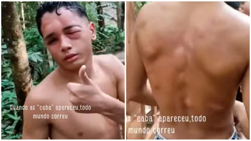 VÍDEO: jovem é atacado por cabas em trilha de Presidente Figueiredo, no AM