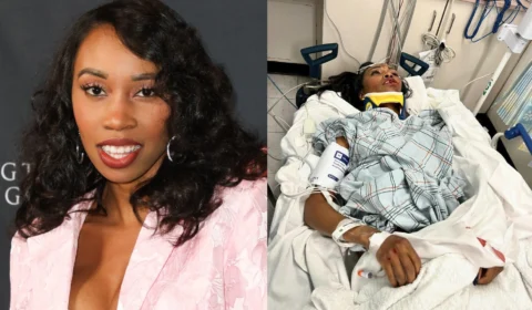 Atriz da Marvel sofre grave acidente e fica desfigurada nos EUA