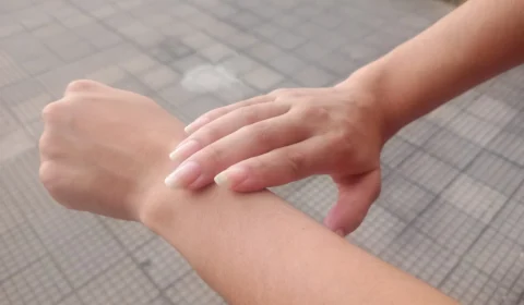 Janeiro Roxo: Ação sobre prevenção a hanseníase será realizada em RR