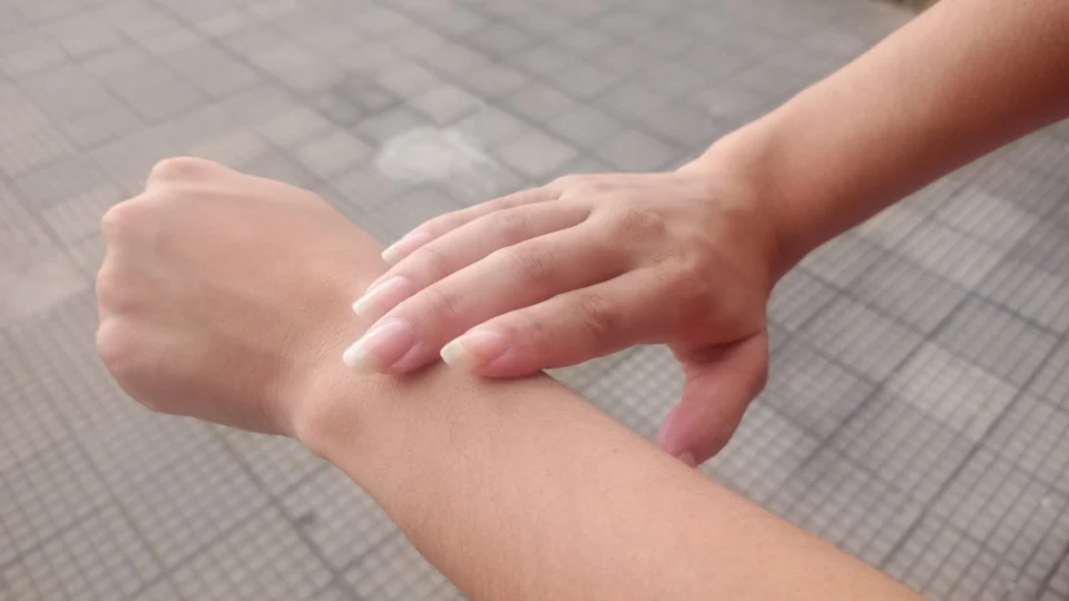 Janeiro Roxo: Ação sobre prevenção a hanseníase será realizada em RR