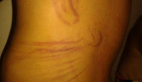 Homem é preso após chicotear esposa grávida e enforcar mãe em GO