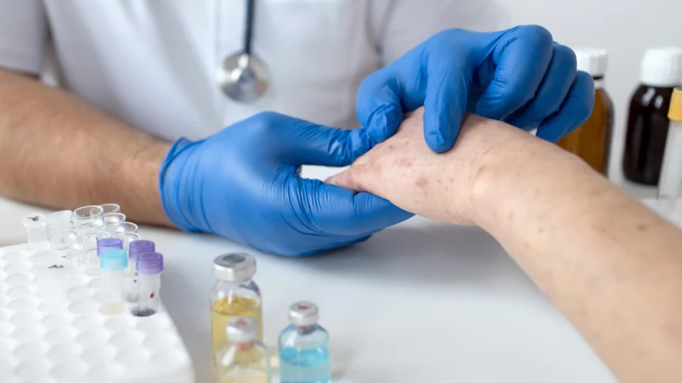 Pessoas com Lúpus tem atendimento preferencial no Amazonas