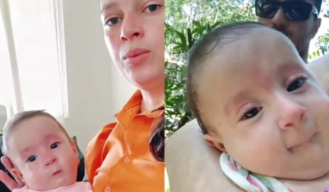 Bebê nasce sem braços e sem pernas e história comove web