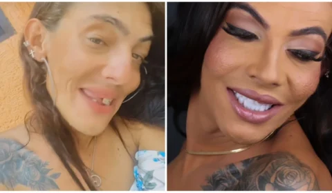 ‘Casal Maloka’ comemora ‘sorriso novo’; confira antes e depois