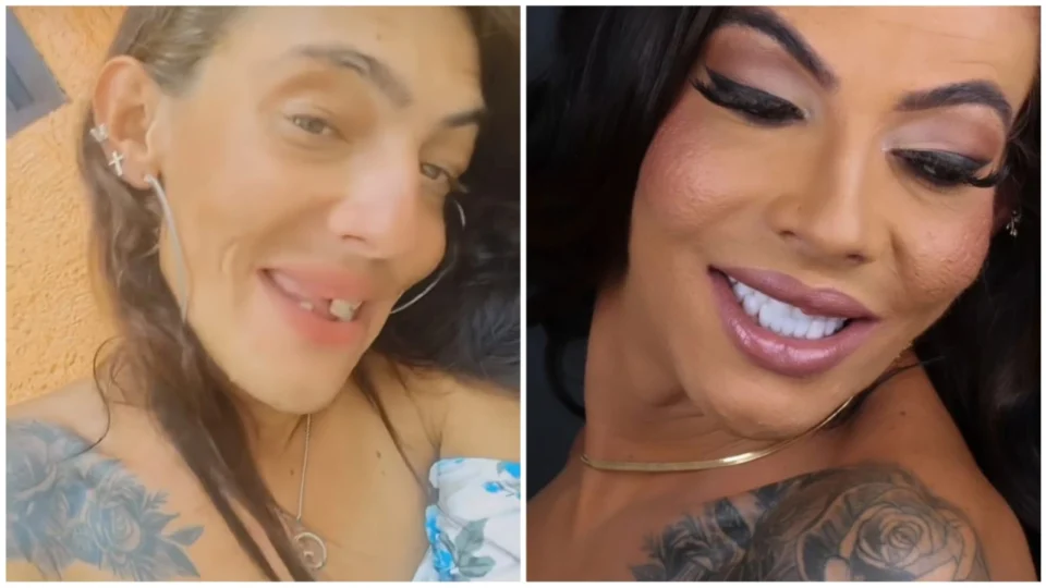 ‘Casal Maloka’ comemora ‘sorriso novo’; confira antes e depois