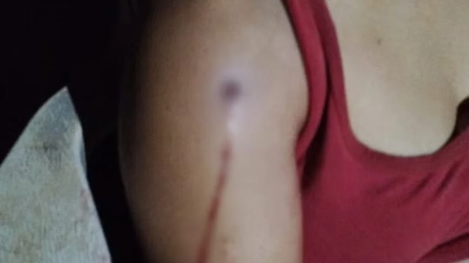 Feminicídio em Roraima: mulher com medida protetiva é morta a tiros pelo ex