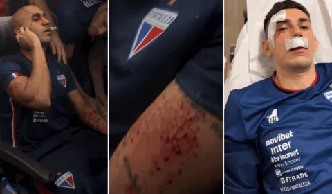 Jogadores do Fortaleza são hospitalizados após ataque em Pernambuco; veja vídeos
