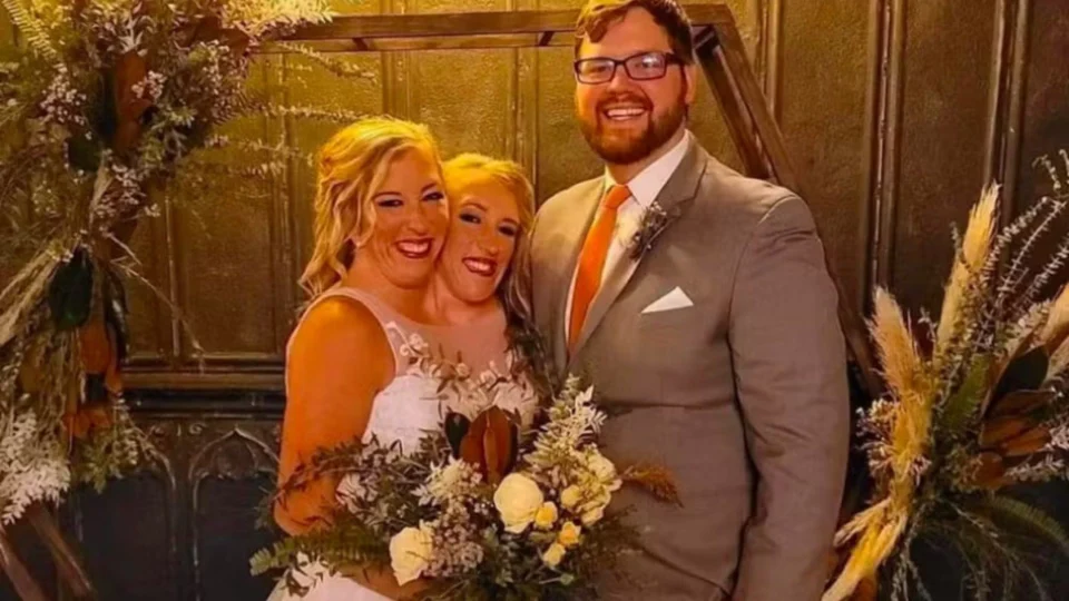 Irmãs siamesas famosas por reality show se casam nos EUA