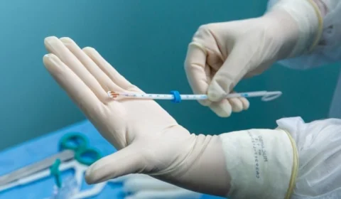 Mutirão alcança marca inédita de inserção de DIU em Manaus