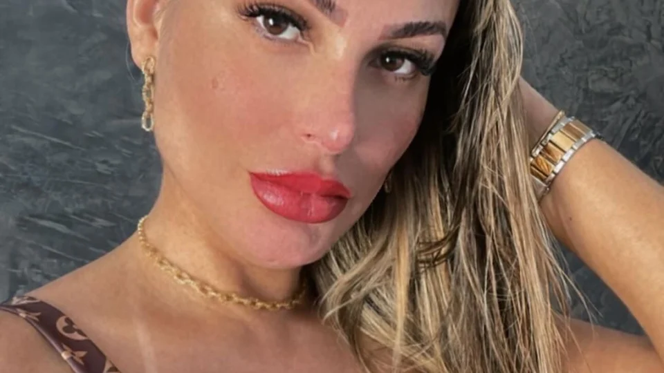 Após cirurgia, Andressa Urach mostra costelas retiradas: ‘Lindas’