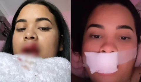 Modelo tem parte do lábio arrancado ao tentar beijar cachorro na boca