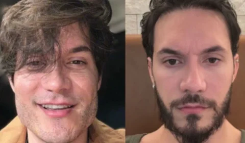 Eliezer reverte harmonização após se chocar com foto: “Caí na real”