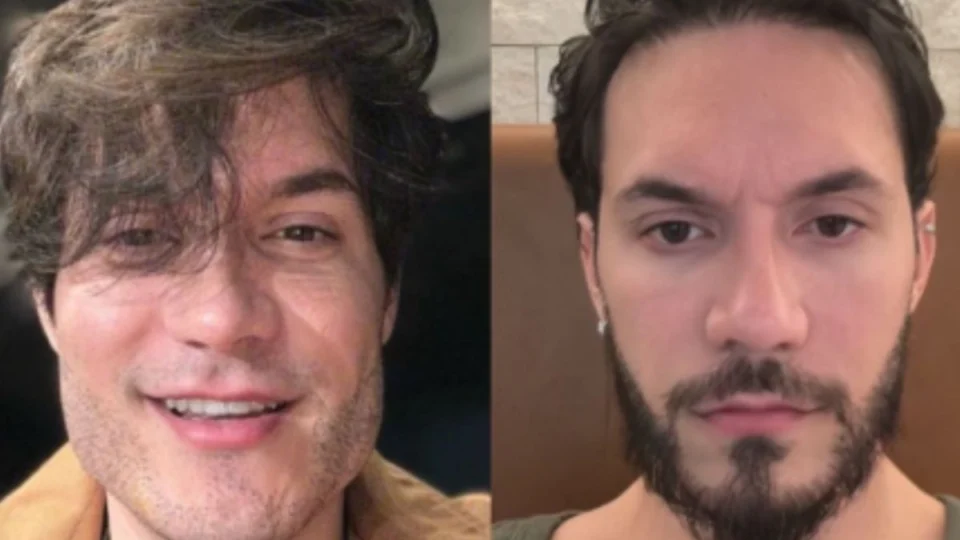 Eliezer reverte harmonização após se chocar com foto: “Caí na real”