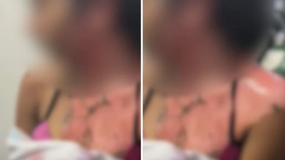VÍDEO FORTE: mulher queima sobrinha e grava tudo com o celular