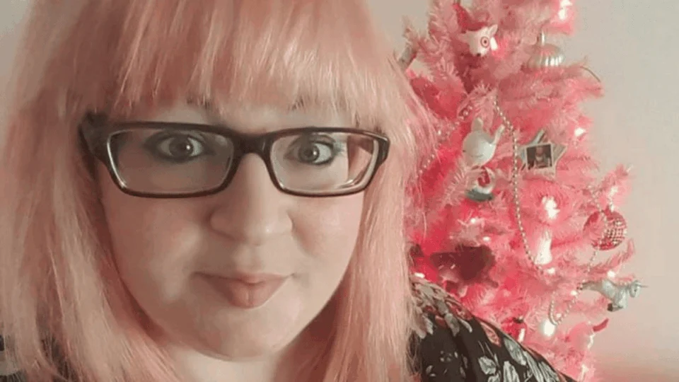 Mulher com ‘pernas de tronco de árvore’ descobre doença rara após bullying