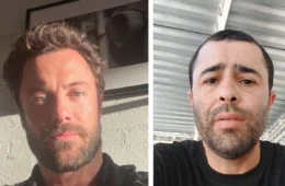 Kayky Brito responde comentário de motorista que o atropelou no Rio