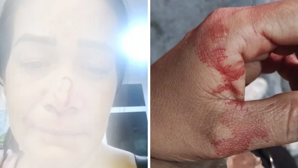 Aluguel de carro acaba em violência: ‘covarde por bater em uma mulher’