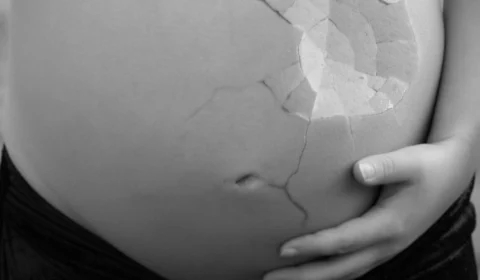 Internautas dividem opiniões sobre PL que equipara aborto ao homicídio