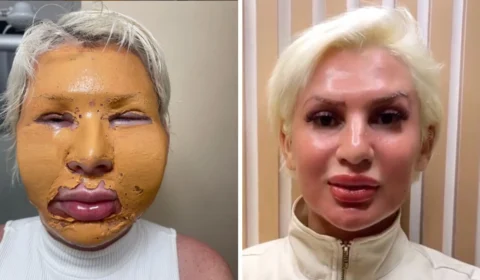 Influencer chora ao lembrar que aplicou fenol em clínica onde jovem morreu