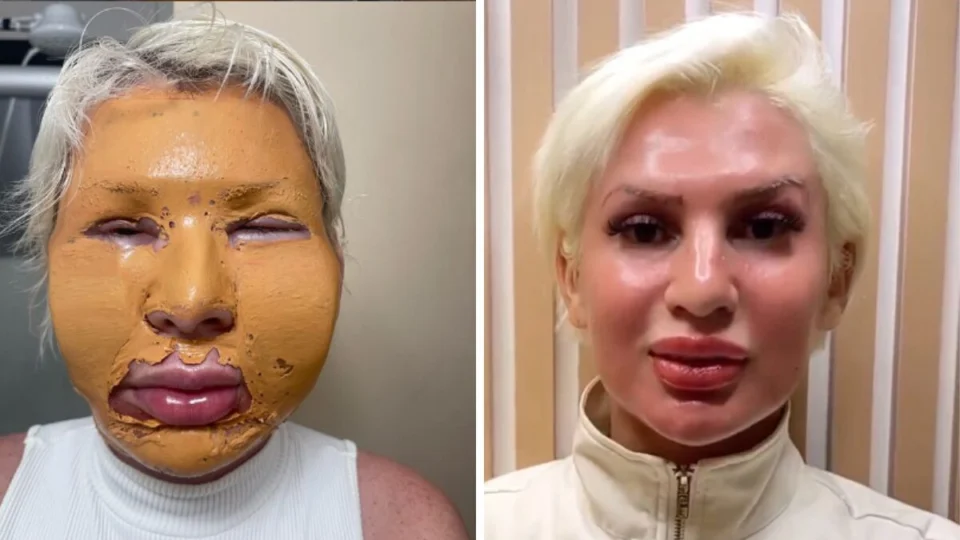 Influencer chora ao lembrar que aplicou fenol em clínica onde jovem morreu