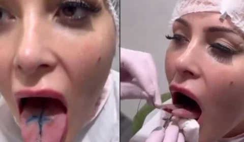 Andressa Urach faz procedimento de ‘língua de cobra’; veja vídeo