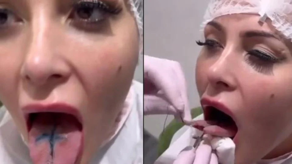 Andressa Urach faz procedimento de ‘língua de cobra’; veja vídeo