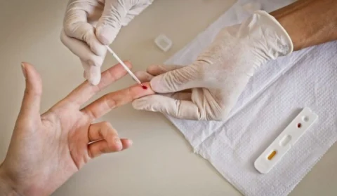 Farmácias são orientadas a realizar testes rápidos para HIV e sífilis