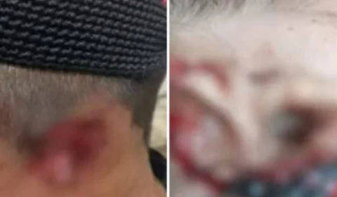 Casal indígena tem orelhas cortadas por membros de facção no AM