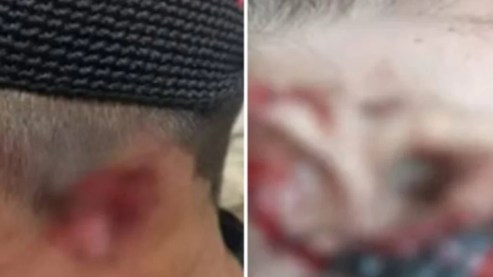 Casal indígena tem orelhas cortadas por membros de facção no AM