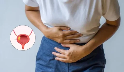 Câncer de bexiga: Brasil ultrapassa 19 mil mortes em 4 anos; veja