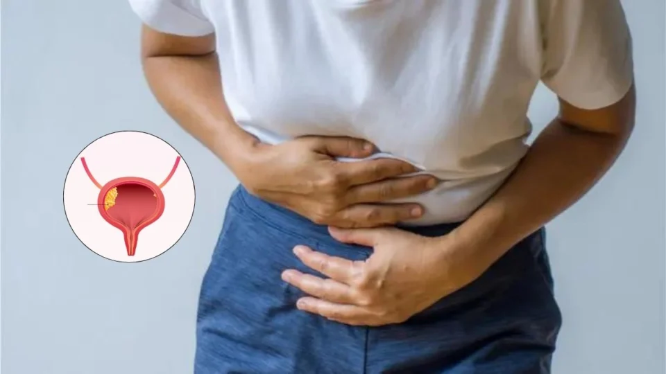 Câncer de bexiga: Brasil ultrapassa 19 mil mortes em 4 anos; veja