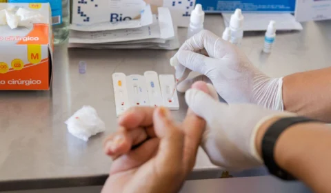 Hepatites virais: Campanha alerta para risco do diagnóstico tardio em Manaus