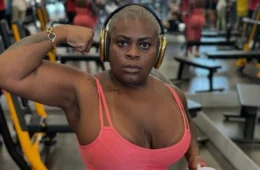 Jojo Todynho mostra resultado após perder 80kg com cirurgia bariátrica e lipoaspiração; veja foto