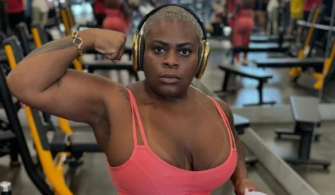 Jojo Todynho mostra resultado após perder 80kg com cirurgia bariátrica e lipoaspiração; veja foto