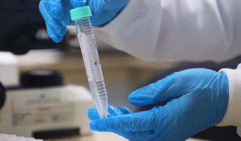 Mpox: Amazonas divulga dados da doença e sugere prevenção