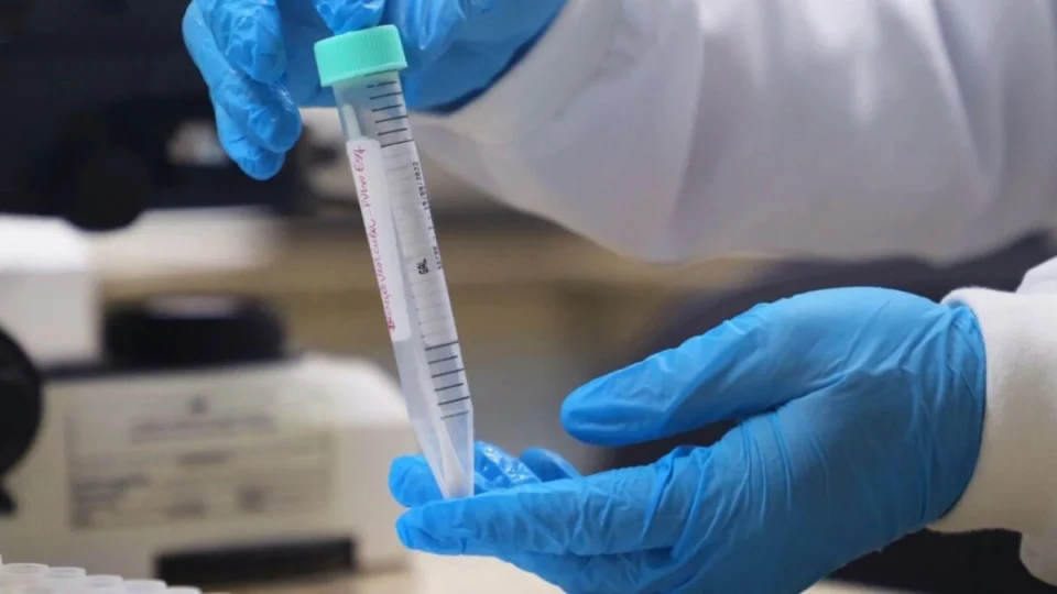 Mpox: Amazonas divulga dados da doença e sugere prevenção